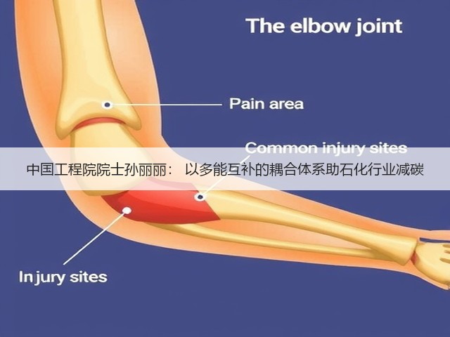 中国工程院院士孙丽丽： 以多能互补的耦合体系助石化行业减碳(图2)