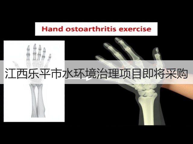 江西乐平市水环境治理项目即将采购(图1)